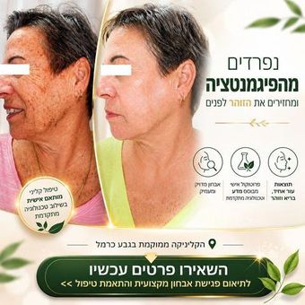 גרפיקת מודעה